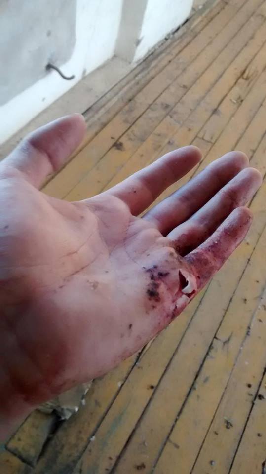 The small cut to my left hand caused by the barbed wire