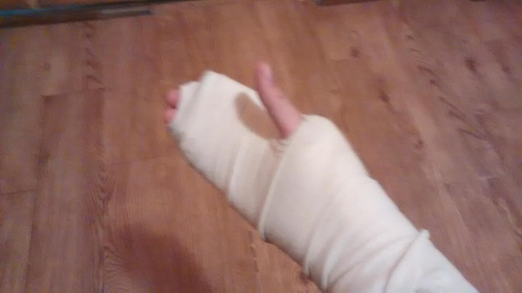 and a heavily bandaged right hand. My comical appearances meant I easily made friends at the hostel.